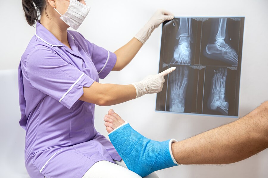 Healing Fractures with Expert Care